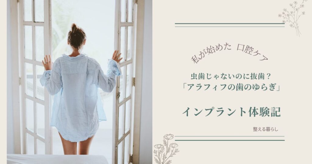 アラフィフのインプラント体験記