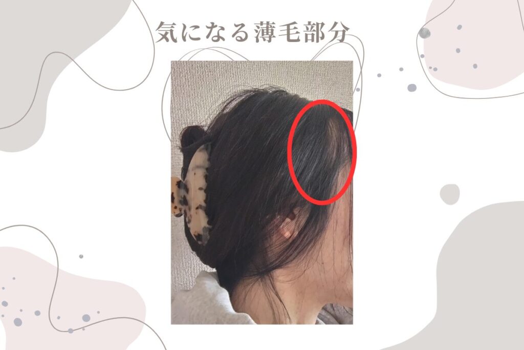 アラフィフ更年期のヘアケア、薄毛箇所を公開